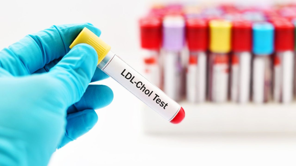 3 bí quyết giữ chỉ số mỡ máu lý tưởng