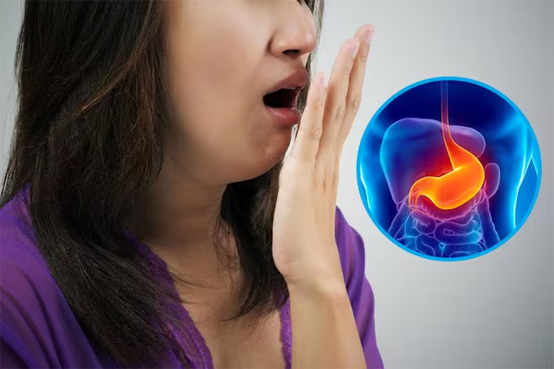 Trào ngược dạ dày thực quản: Nguyên nhân và dấu hiệu nhận biết