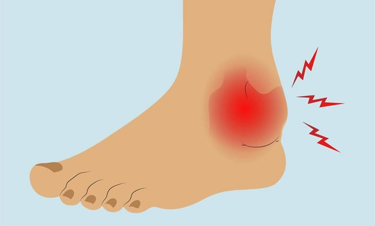 Dấu hiệu bệnh tim mạch