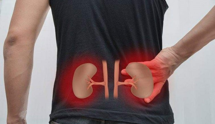 Suy thận cấp là gì? 4 điều cần biết về suy thận cấp để điều trị hiệu quả
