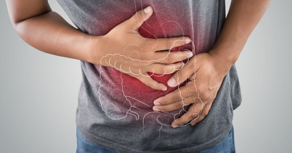 Viêm đại tràng: 7 điều cần biết và cách phòng tránh hiệu quả