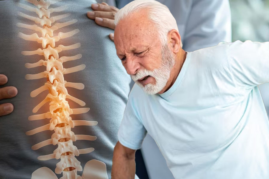 Bệnh loãng xương: Nguyên nhân, triệu chứng và cách phòng ngừa