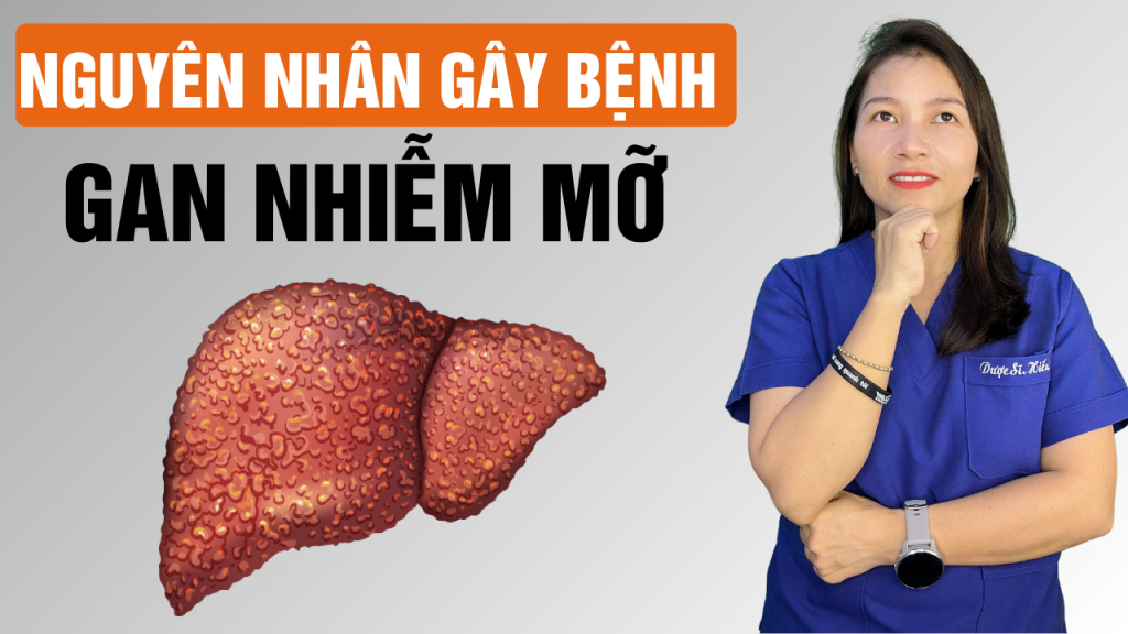 5 nguyên nhân gây ra bệnh gan nhiễm mỡ