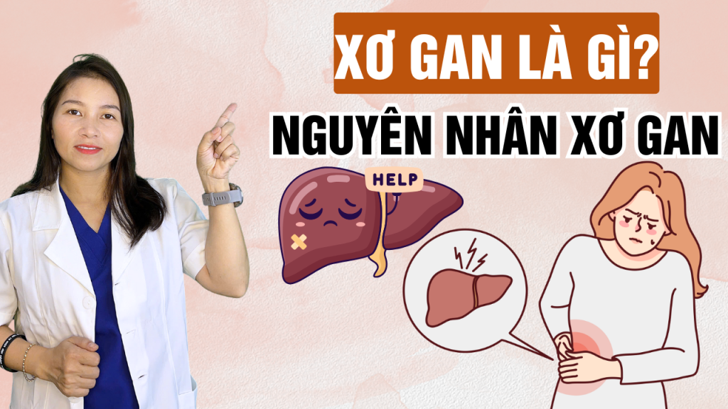 Xơ gan là gì? 5 nguyên nhân dẫn đến bệnh xơ gan